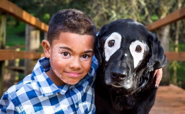 Le garçon a rencontré un chien qui avait la même maladie que lui et a cessé de se sentir étrange